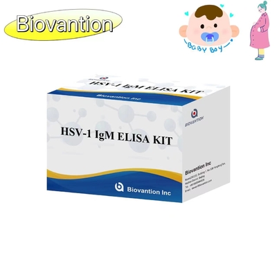 トーチ ELISA テストキット HSV 1 IgM 高熱売り診断反応体 IVD