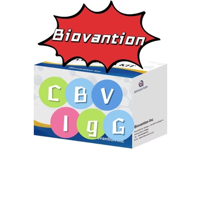 CBV-IgG抗体の診断キット ELISAテストキット 血清検査キット
