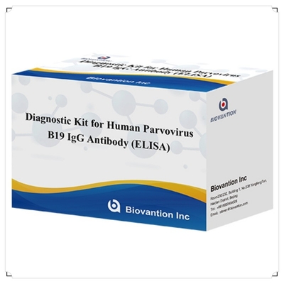 工場直販 B19 ELISA キット 人体パーボウイルス B19 IgM 抗体 Elisa テスト キット 96T
