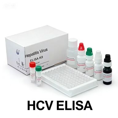 肝炎 C ウイルス に 対する 抗 HCV 抗体 酵素 関連 輸送 時間 短
