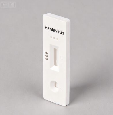 ハンタンウイルス HTNV IgM 迅速検査キット 定性検知 読み取り時間15〜20分 100% までの感度