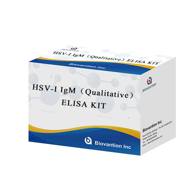 高性能で敏感な検査のためのヘルペス単純ウイルス (HSV-I) I IgM ELISAキットに対する抗体