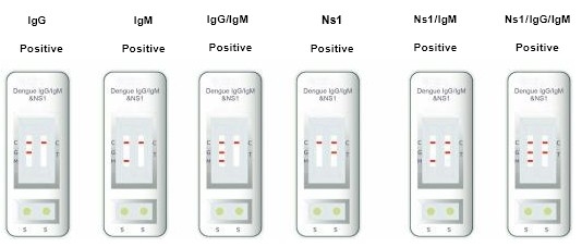 病院,医療センター,自己高精度1段階デング熱IgG&IgM検査キット