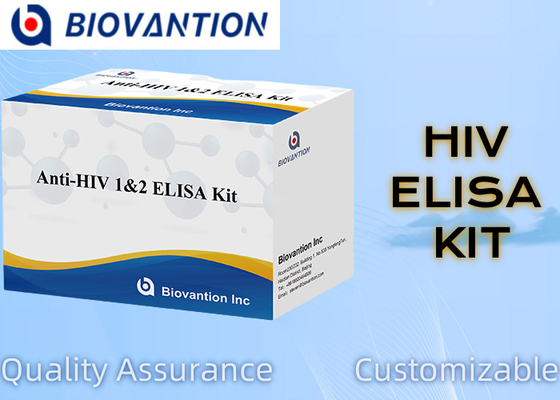 ビオバンション 抗HIV ELISA 検査キット HIV-1 と HIV-2 検査の有効期限 18ヶ月