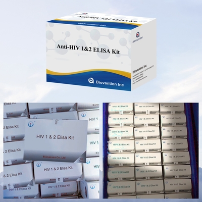ビオバンション 抗HIV ELISA 検査キット HIV-1 と HIV-2 検査の有効期限 18ヶ月