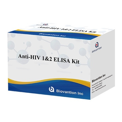 HIV エリザ検査キット 18ヶ月 保存期間 エリザ検査 高い感度と特異性