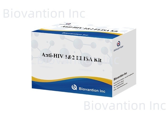 ビオバンション 抗HIV ELISA 検査キット HIV-1 と HIV-2 検査の有効期限 18ヶ月
