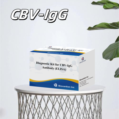 CBV-IgG抗体の人体検知に対する敏感性診断キット 精密なサンプルタイプ検知のためのエリサキット