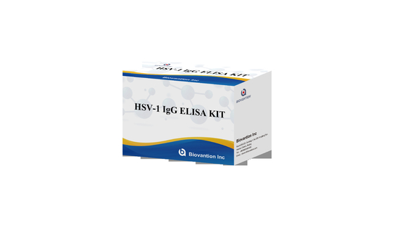 HSV 1 IgG トーチ ELISA テストキット 高熱売り診断反応体 IVD