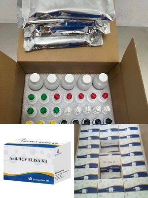 肝炎 C ウイルス に 対する 抗 HCV 抗体 酵素 関連 輸送 時間 短