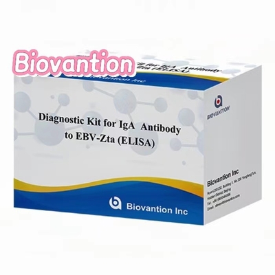 EBV-Zta ELISA 検査キットに対する IgA 抗体診断キット