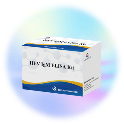 正確で敏感なエリサ検査キット HEV-IgM 診断と分析