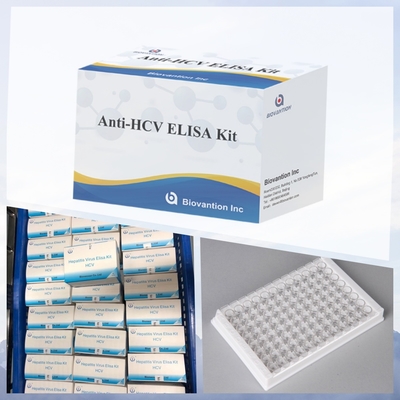 新しい到着 IVD 反応剤 HCV 診断反応剤 ヒト病院臨床試験室用