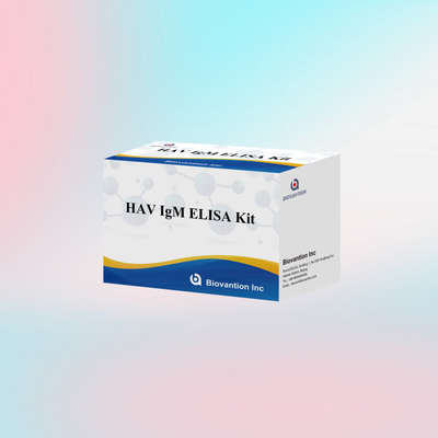 HAV IgM ELISA テストキット 人体診断反応体