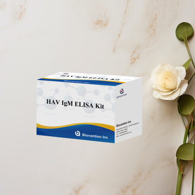 HAV IgM ELISA キット 高感度 A型肝炎 ウイルス検出 臨床実験室用の信頼性のある正確な診断検査