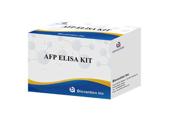AFP ELISA キット 肝細胞がん HCCスクリーニング AFP ELISA キット 母乳血清