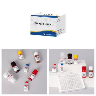 96T CMV ELISA テストキット 細胞メガロウイルス抗体のための色測定検出とサンドイッチ方法