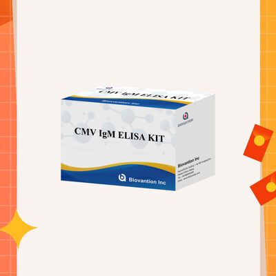 96T CMV ELISA テストキット 細胞メガロウイルス抗体のための色測定検出とサンドイッチ方法