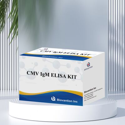 96T CMV ELISA テストキット 細胞メガロウイルス抗体のための色測定検出とサンドイッチ方法