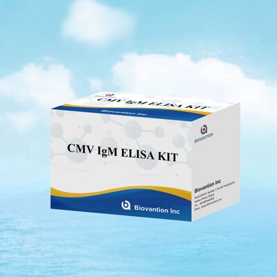96T CMV ELISA テストキット 細胞メガロウイルス抗体のための色測定検出とサンドイッチ方法