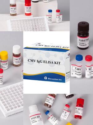 研究室または病院 高精度 CMV IgG Elisa 検査キット