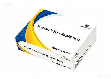 Factory Supply Hantaan Virus Rapid Test Cassette Hantan Antigen Rapid Test Kit