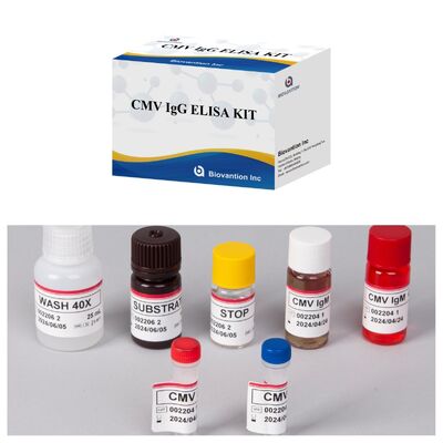 96T CMV ELISA テストキット 細胞メガロウイルス抗体のための色測定検出とサンドイッチ方法